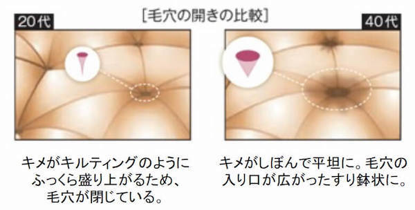毛穴が目立つイメージ